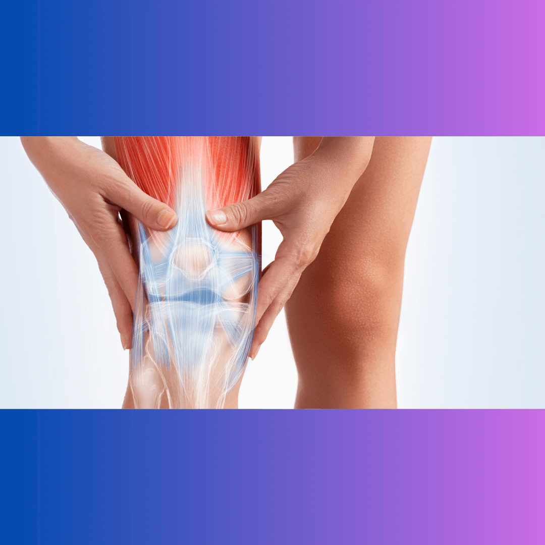 СНимката е към статия от блога на Терапио и показва коляно на човек страдащ от артрит